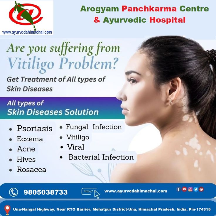 Vitiligo treatment Una Himachal Pradesh