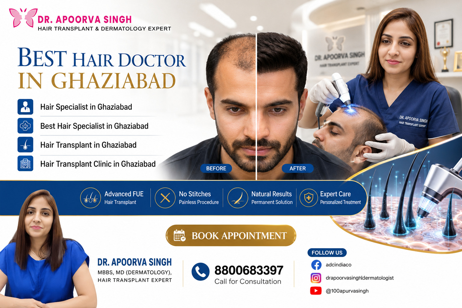 Hair Specialist doctor in Ghaziabad